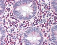 Immunohistochemistry (Formalin/PFA-fixed paraffin-embedded sections) - Anti-IRGM antibody (AB118569)