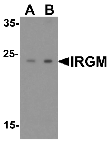 Western blot - Anti-IRGM antibody (AB69495)