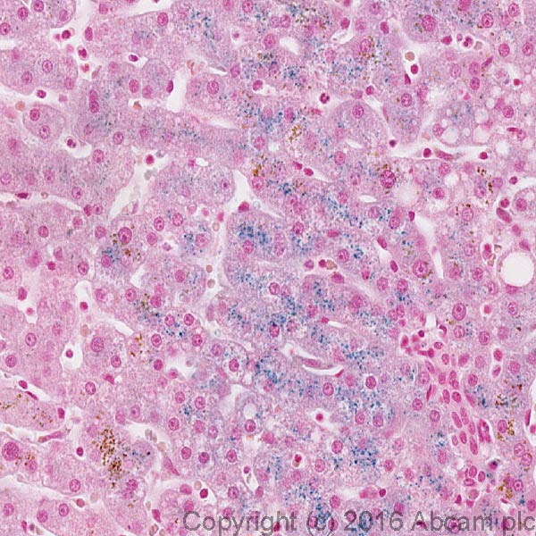 Immunohistochemistry (Formalin/PFA-fixed paraffin-embedded sections) - Iron Stain Kit (Prussian Blue Stain) (AB150674), expandable thumbnail