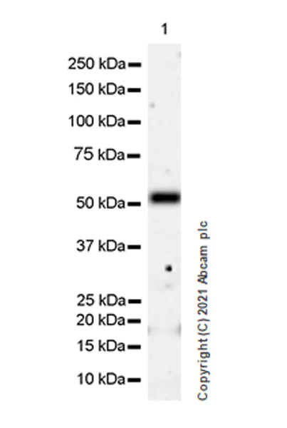 Western blot - Anti-IRR antibody [EPR24776-127] (AB273125)