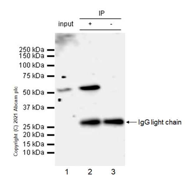 Immunoprecipitation - Anti-IRR antibody [EPR24776-127] - BSA and Azide free (AB282736), expandable thumbnail
