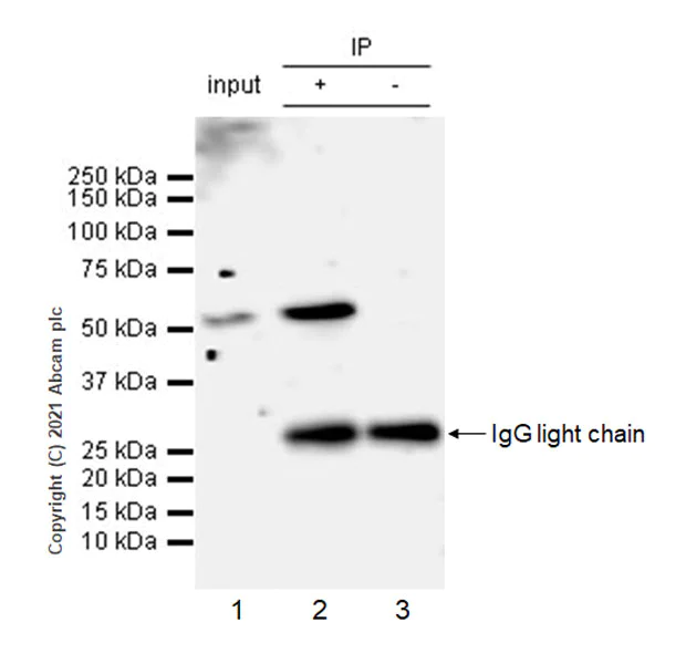 Immunoprecipitation - Anti-IRR antibody [EPR24776-127] - BSA and Azide free (AB282736)