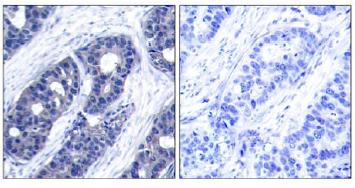 Immunohistochemistry (Formalin/PFA-fixed paraffin-embedded sections) - Anti-IRS1 antibody (AB131487)
