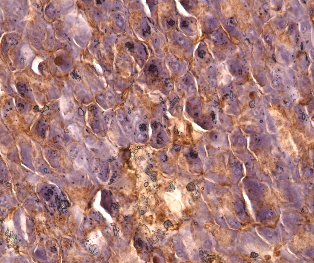 Immunohistochemistry (Formalin/PFA-fixed paraffin-embedded sections) - Anti-IRS1 antibody (AB131487)