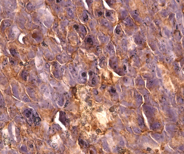 Immunohistochemistry (Formalin/PFA-fixed paraffin-embedded sections) - Anti-IRS1 antibody (AB131487)