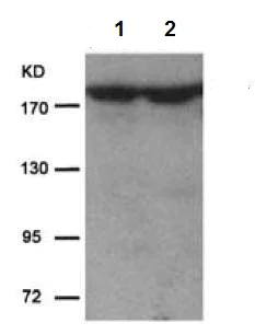 Western blot - Anti-IRS1 antibody (AB131509)