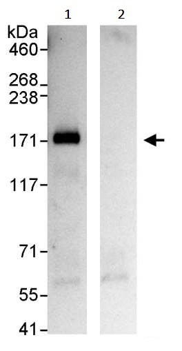 Immunoprecipitation - Anti-IRS1 antibody (AB245313)