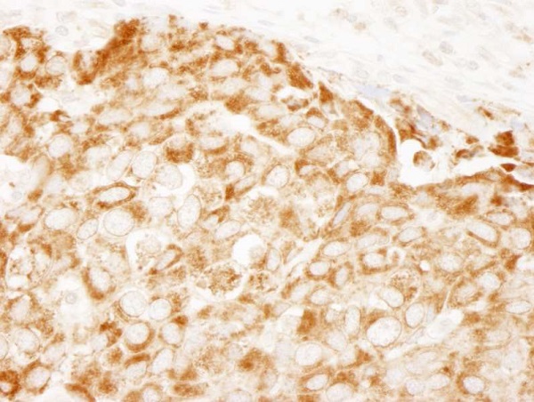 Immunohistochemistry (Formalin/PFA-fixed paraffin-embedded sections) - Anti-IRS1 antibody (AB245314)