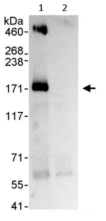 Immunoprecipitation - Anti-IRS1 antibody (AB245314)
