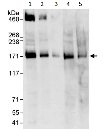 Western blot - Anti-IRS1 antibody (AB245314)