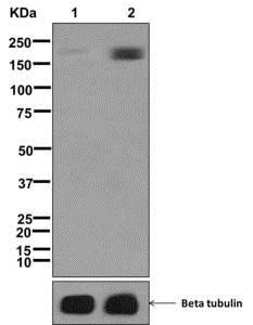 Western blot - Anti-IRS1 (phospho S1101) + IRS2 (phospho S1149) antibody [EPR2350(2)] (AB178703)