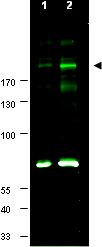 Western blot - Anti-IRS1 (phospho S307) antibody (AB1194), expandable thumbnail
