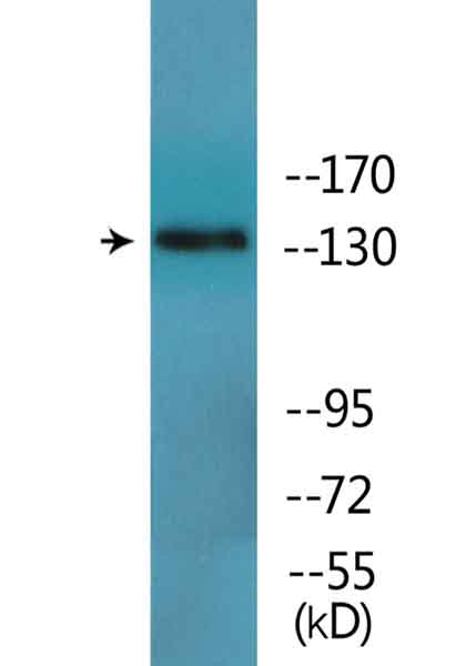 Western blot - Anti-IRS1 (phospho S312) antibody (AB138456)