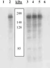 Western blot - Anti-IRS1 (phospho S312) antibody (AB4865)