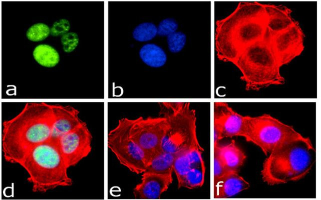 Immunocytochemistry/ Immunofluorescence - Anti-IRS1 (phospho S312) antibody [RP23040108] (AB313437), expandable thumbnail