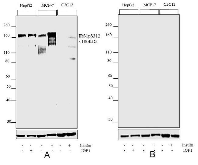 Western blot - Anti-IRS1 (phospho S312) antibody [RP23040108] (AB313437), expandable thumbnail