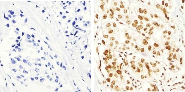 Immunohistochemistry (Formalin/PFA-fixed paraffin-embedded sections) - Anti-IRS1 (phospho S616) antibody (AB4776)