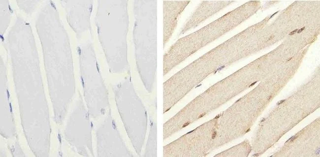 Immunohistochemistry (Formalin/PFA-fixed paraffin-embedded sections) - Anti-IRS1 (phospho S616) antibody (AB4776)