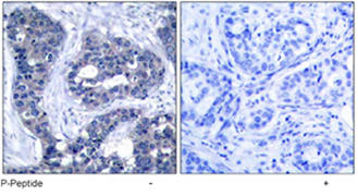Immunohistochemistry (Formalin/PFA-fixed paraffin-embedded sections) - Anti-IRS1 (phospho S639) antibody (AB47404)