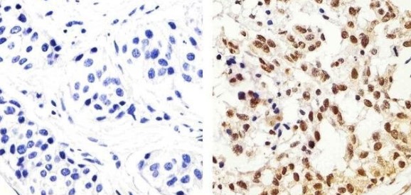 Immunohistochemistry (Formalin/PFA-fixed paraffin-embedded sections) - Anti-IRS1 (phospho Y896) antibody (AB4873)