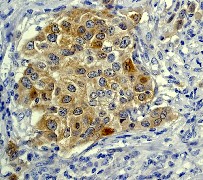 Immunohistochemistry (Formalin/PFA-fixed paraffin-embedded sections) - Anti-IRS1+IRS2 antibody [EP263Y] (ab40777), expandable thumbnail
