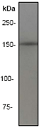 Western blot - Anti-IRS1+IRS2 antibody [EP263Y] (ab40777), expandable thumbnail