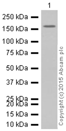 Western blot - Anti-IRS1+IRS2 antibody [EP263Y] (AB40777), expandable thumbnail