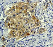 Immunohistochemistry (Formalin/PFA-fixed paraffin-embedded sections) - Anti-IRS1+IRS2 antibody [EP263Y] - BSA and Azide free (AB247286)