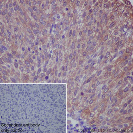 Immunohistochemistry (Formalin/PFA-fixed paraffin-embedded sections) - Anti-IRS1+IRS2 antibody [EP263Y] - BSA and Azide free (AB247286)