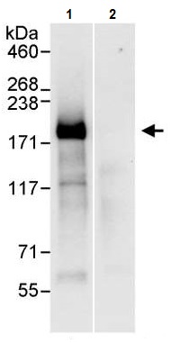 Immunoprecipitation - Anti-IRS2 antibody (AB245386)