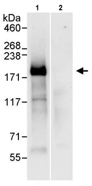 Immunoprecipitation - Anti-IRS2 antibody (AB245386)
