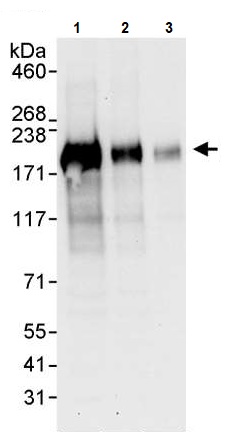 Western blot - Anti-IRS2 antibody (AB245386)