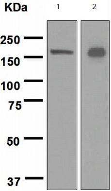 Western blot - Anti-IRS2 antibody [EPR1650(2)] (AB133276)