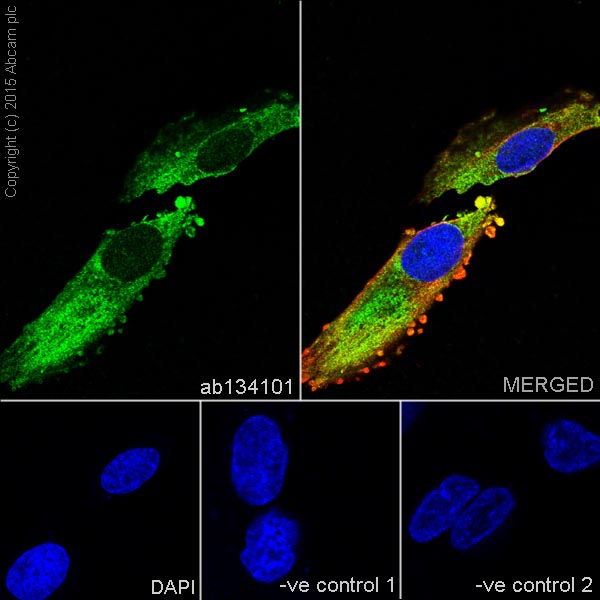 Immunocytochemistry/ Immunofluorescence - Anti-IRS2 antibody [EPR904(2)] (AB134101), expandable thumbnail