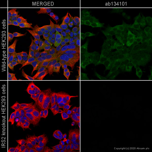 Immunocytochemistry/ Immunofluorescence - Anti-IRS2 antibody [EPR904(2)] (AB134101), expandable thumbnail