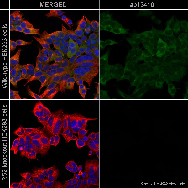 Immunocytochemistry/ Immunofluorescence - Anti-IRS2 antibody [EPR904(2)] (AB134101)