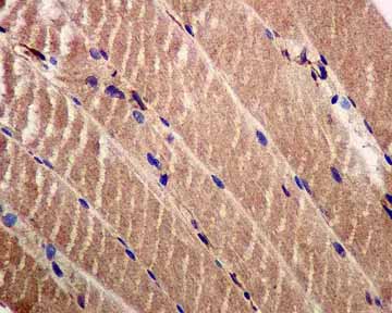 Immunohistochemistry (Formalin/PFA-fixed paraffin-embedded sections) - Anti-IRS2 antibody [EPR904(2)] (ab134101), expandable thumbnail