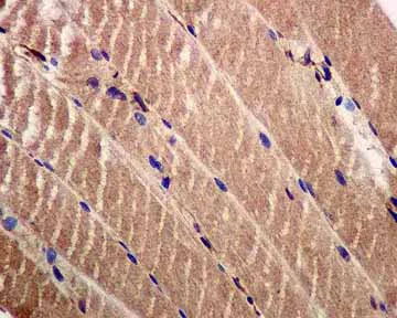 Immunohistochemistry (Formalin/PFA-fixed paraffin-embedded sections) - Anti-IRS2 antibody [EPR904(2)] (AB134101)