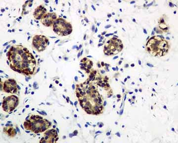 Immunohistochemistry (Formalin/PFA-fixed paraffin-embedded sections) - Anti-IRS2 antibody [EPR904(2)] (ab134101), expandable thumbnail