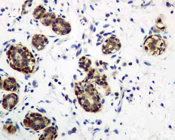 Immunohistochemistry (Formalin/PFA-fixed paraffin-embedded sections) - Anti-IRS2 antibody [EPR904(2)] (AB134101)