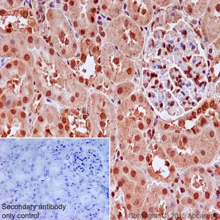 Immunohistochemistry (Formalin/PFA-fixed paraffin-embedded sections) - Anti-IRS2 antibody [EPR904(2)] (AB134101)