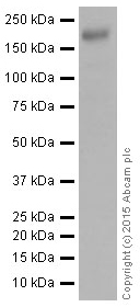 Western blot - Anti-IRS2 antibody [EPR904(2)] (ab134101), expandable thumbnail