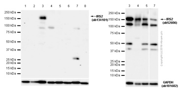Western blot - Anti-IRS2 antibody [EPR904(2)] (ab134101), expandable thumbnail
