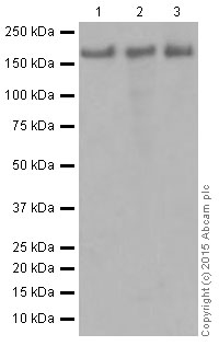 Western blot - Anti-IRS2 antibody [EPR904(2)] (ab134101), expandable thumbnail