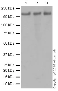 Western blot - Anti-IRS2 antibody [EPR904(2)] (AB134101)