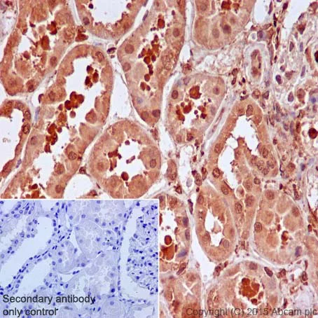 Immunohistochemistry (Formalin/PFA-fixed paraffin-embedded sections) - Anti-IRS2 antibody [EPR904(2)] - BSA and Azide free (AB208195)