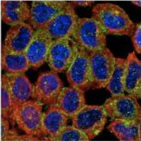 Immunocytochemistry/ Immunofluorescence - Anti-IRSp53 antibody (AB126057)
