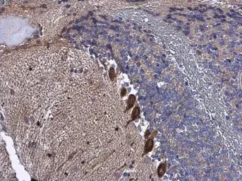 Immunohistochemistry (Formalin/PFA-fixed paraffin-embedded sections) - Anti-IRSp53 antibody (AB126057)