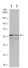 Western blot - Anti-IRSp53 antibody (AB126057)