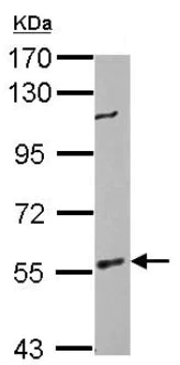 Western blot - Anti-IRSp53 antibody (AB126057)